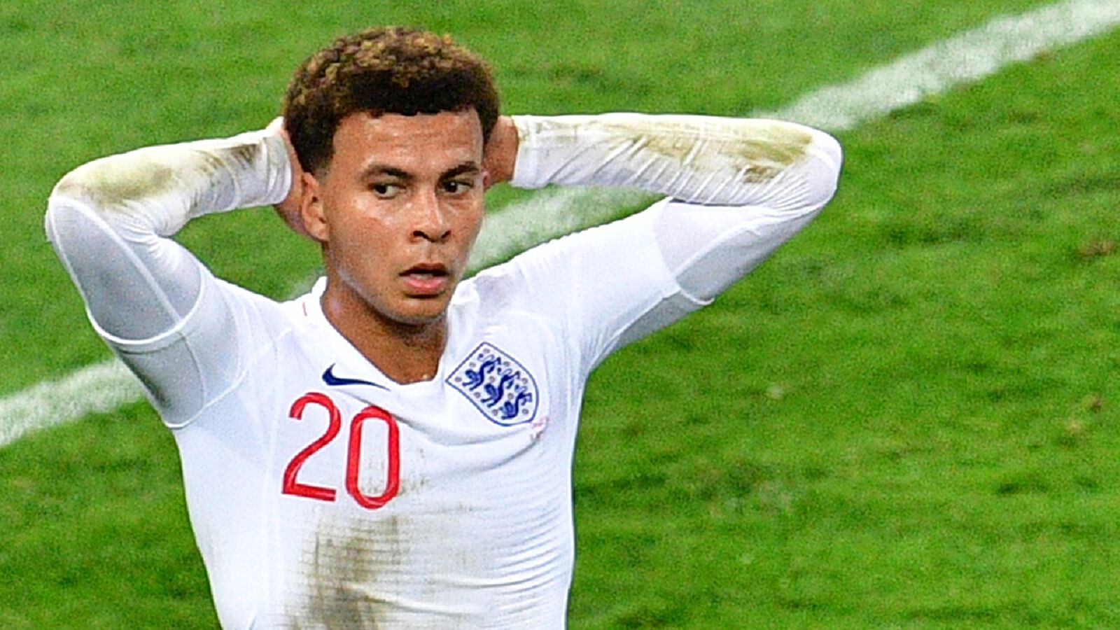 เรื่องผมไว้ใจอัลลี! เดเล่ เผาเพื่อน ทรงผมใครโคตรเท่ ใครโคตรแย่ เรื่องผมไว้ใจอัลลี! เดเล่ เผาเพื่อน ทรงผมใครโคตรเท่ ใครโคตรแย่