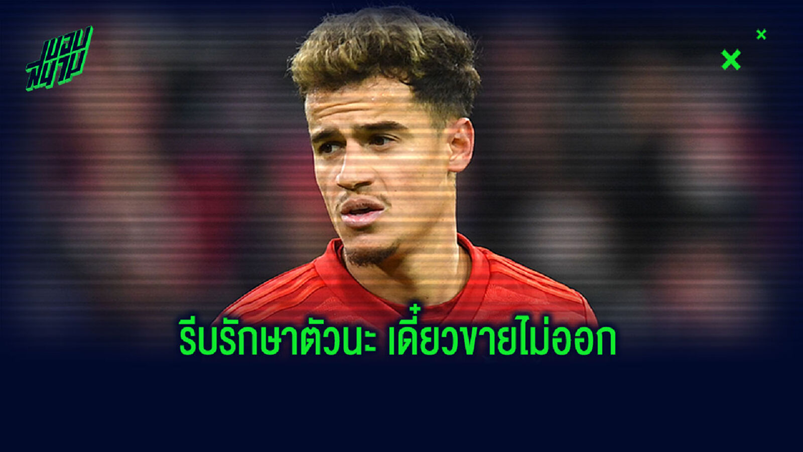 รีบรักษาเดี๋ยวขายไม่ออก! ภาพ คูตี้ ใช้ไม้ค้ำ ผ่าตัดรักษาข้อเท้า รีบรักษาเดี๋ยวขายไม่ออก! ภาพ คูตี้ ใช้ไม้ค้ำ ผ่าตัดรักษาข้อเท้า