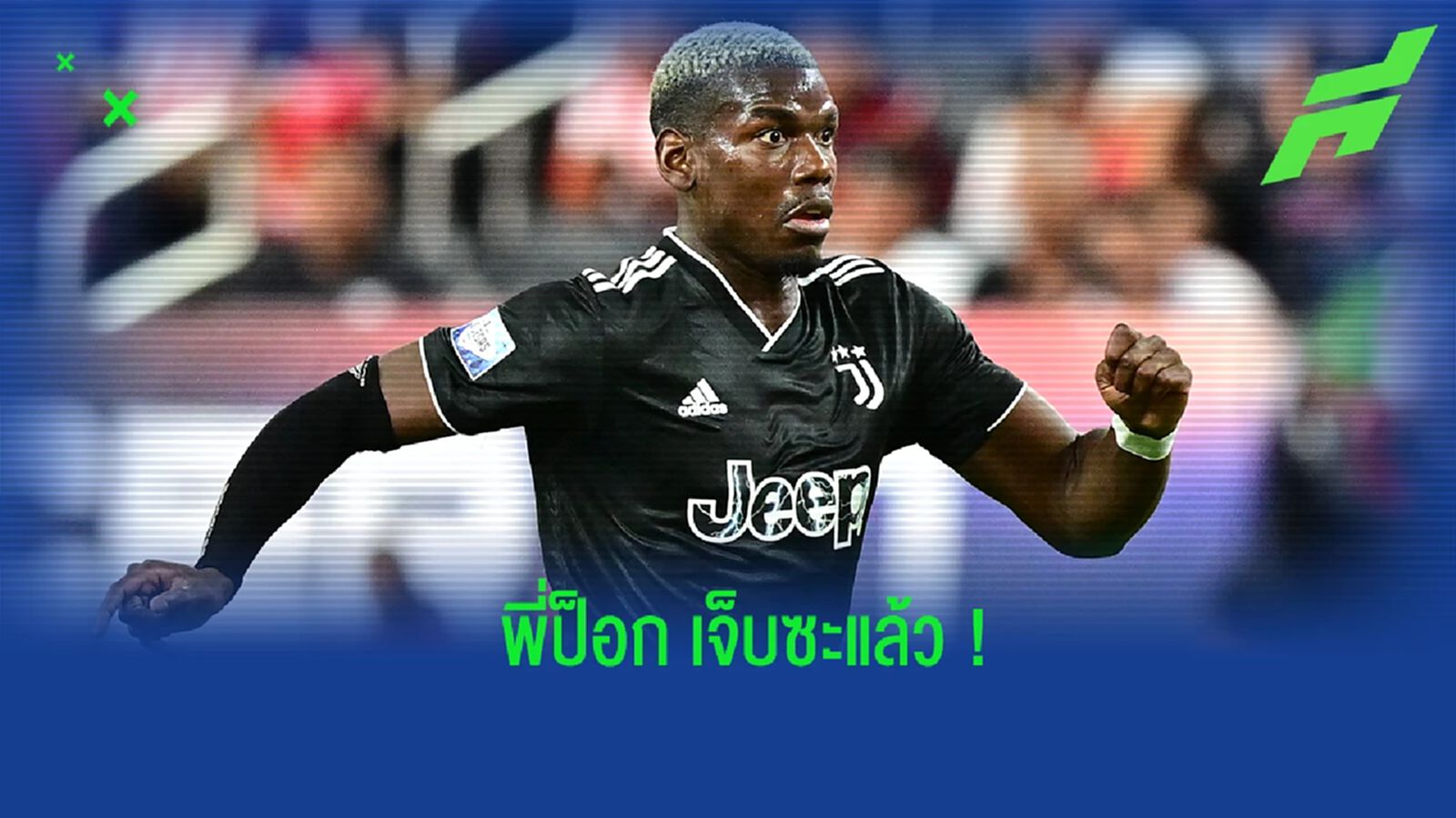 งานเข้า! ป็อกบา เจ็บหัวเข่า คาดหายไม่ทันเกมนัดเปิดสนามศึก เซเรีย อา งานเข้า! ป็อกบา เจ็บหัวเข่า คาดหายไม่ทันเกมนัดเปิดสนามศึก เซเรีย อา