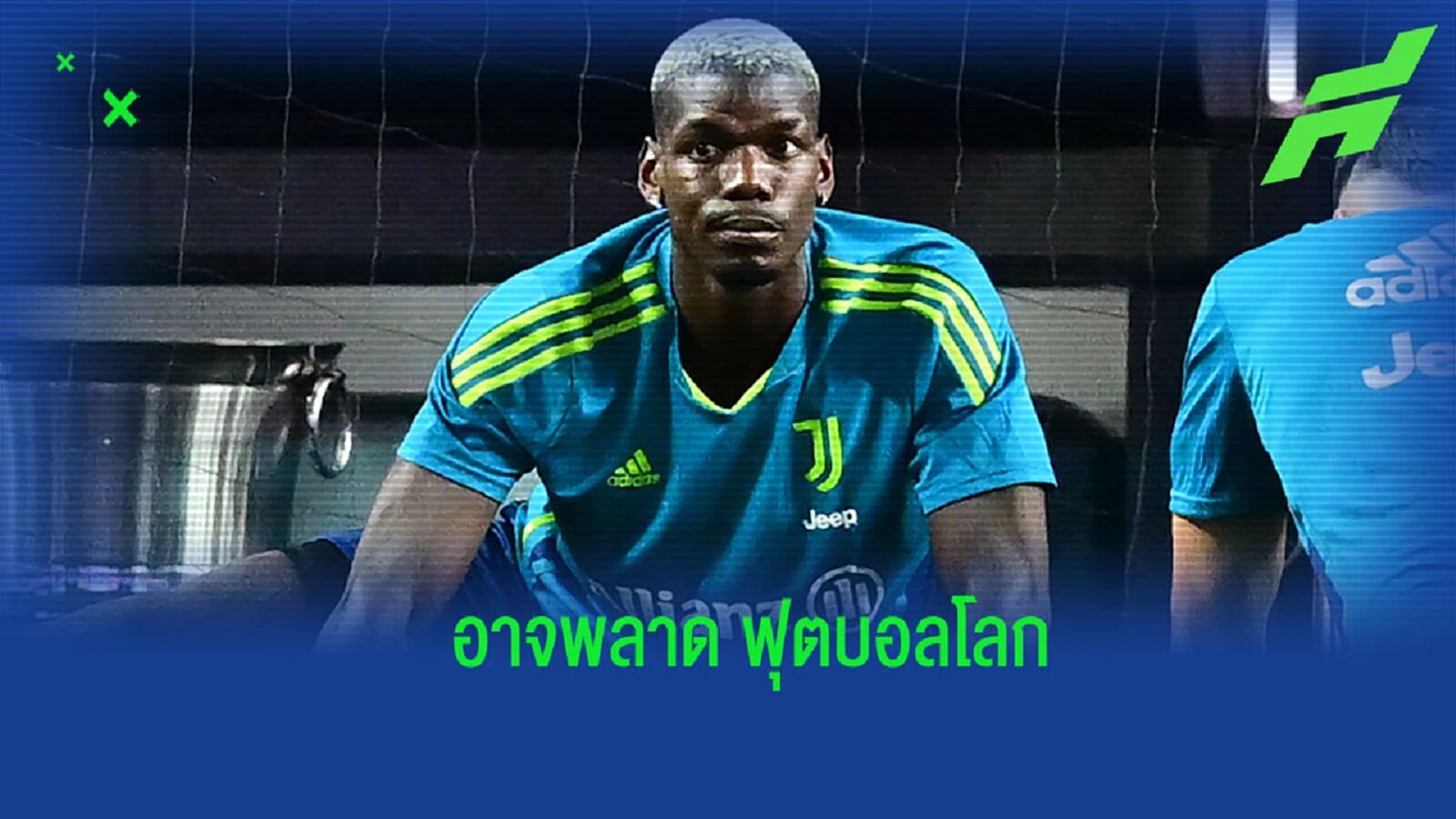 ยูเว่ เจื่อน! ป็อกบา เข่าพังหนัก อาจรักษาตัวนานครึ่งปี