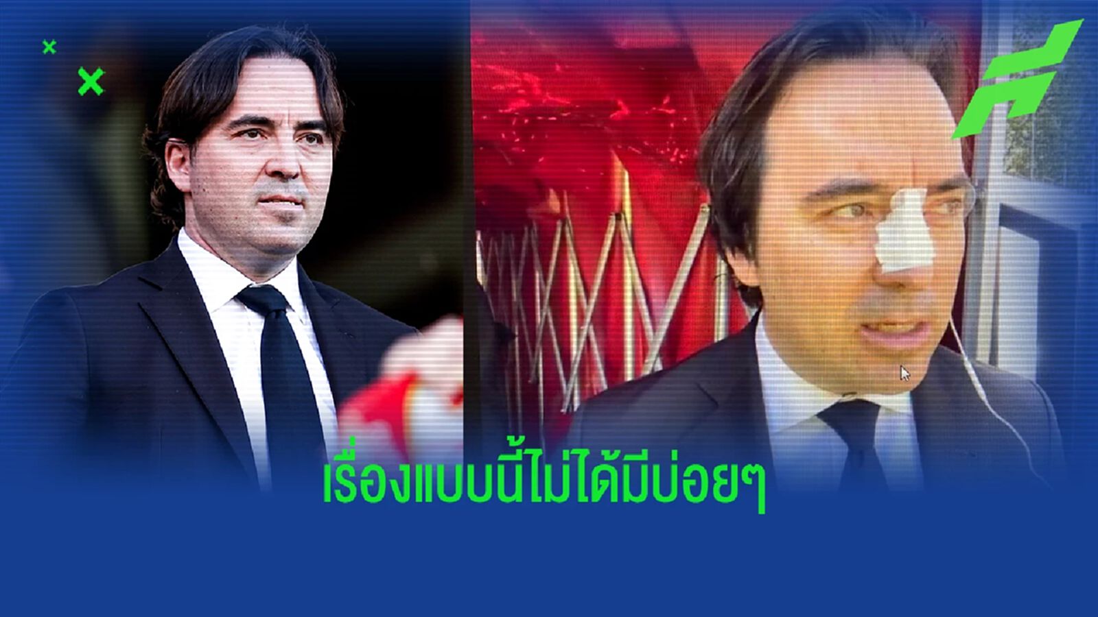 เมื่อ ประธานสโมสร โดน เอเยนต์ เฮตบัตต์ ใส่ ? เมื่อ ประธานสโมสร โดน เอเยนต์ เฮตบัตต์ ใส่ ?