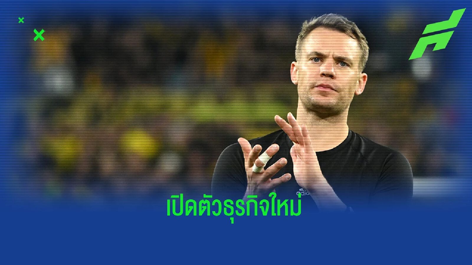 นอยเออร์ เผยเคยผ่าตัดรักษามะเร็งที่หน้าถึง 3 ครั้ง