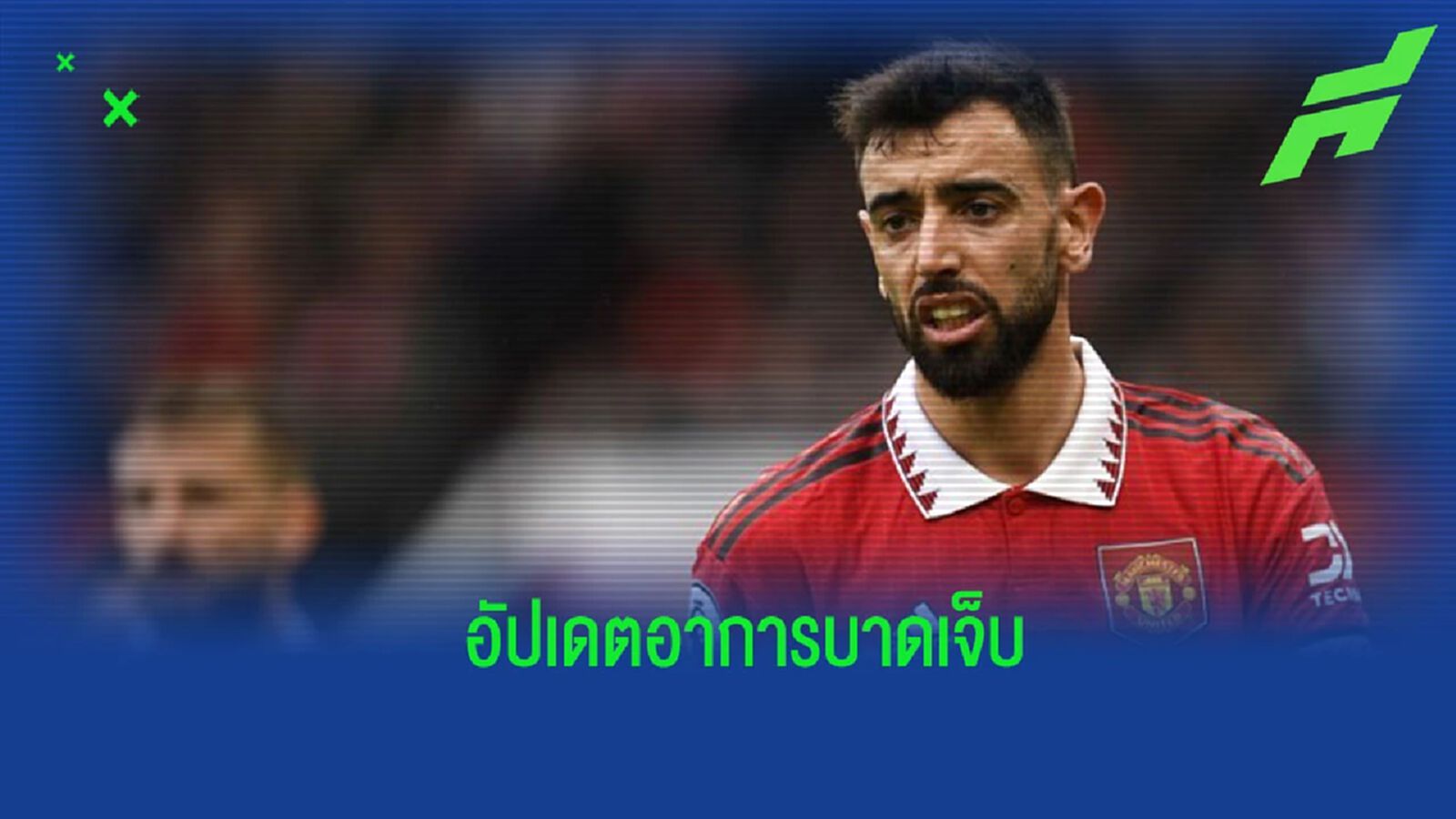 คนเหล็ก? “บรูโน่” เปิดใจ กล่าวถึงอาการบาดเจ็บของตนเอง คนเหล็ก? “บรูโน่” เปิดใจ กล่าวถึงอาการบาดเจ็บของตนเอง