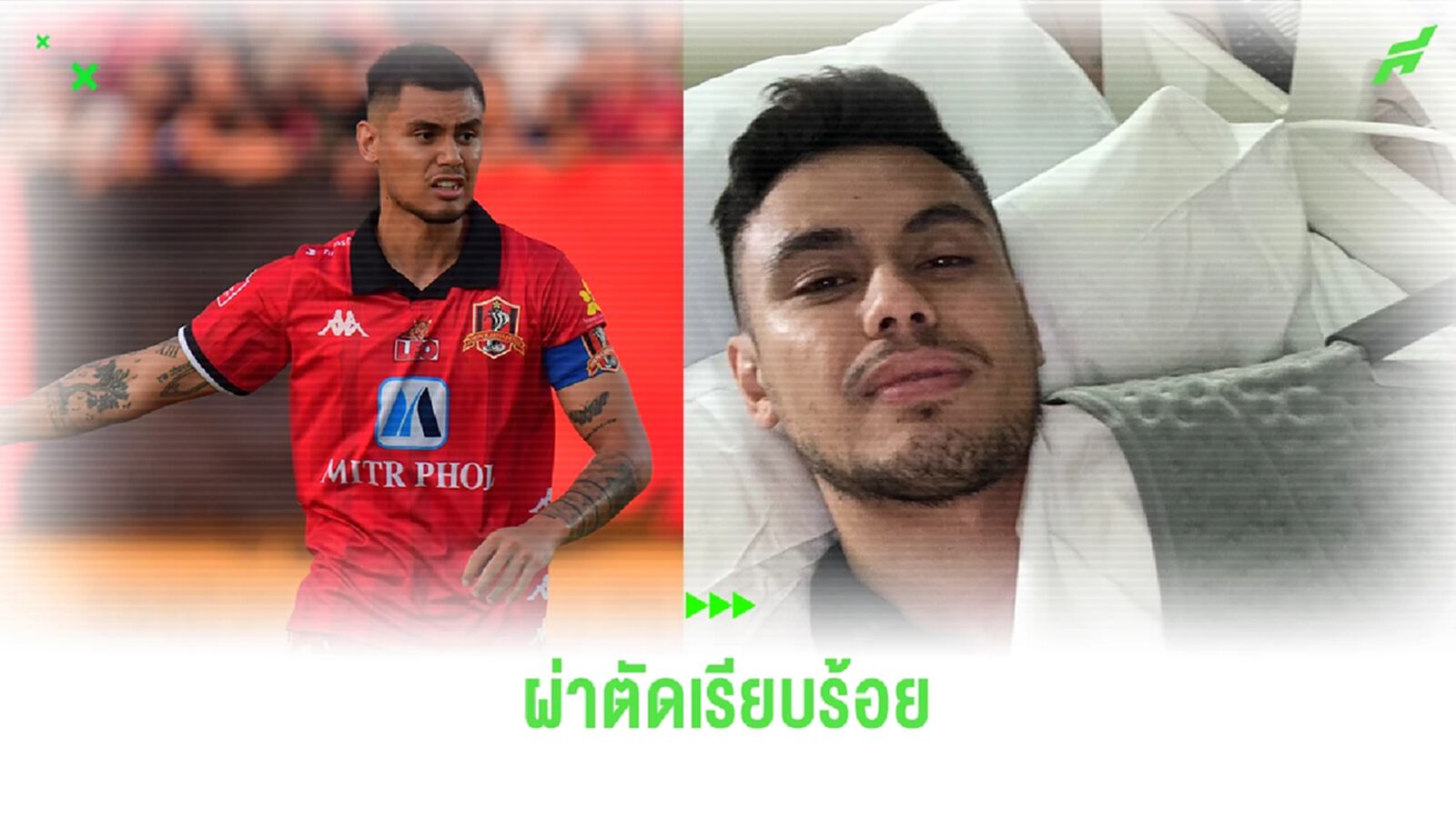 โจชัว กรอมเมน ผ่าตัดหัวไหล่ฉลุย พักฟื้น 3 เดือน คัมแบ็คช่วยขอนแก่นได้เลก 2