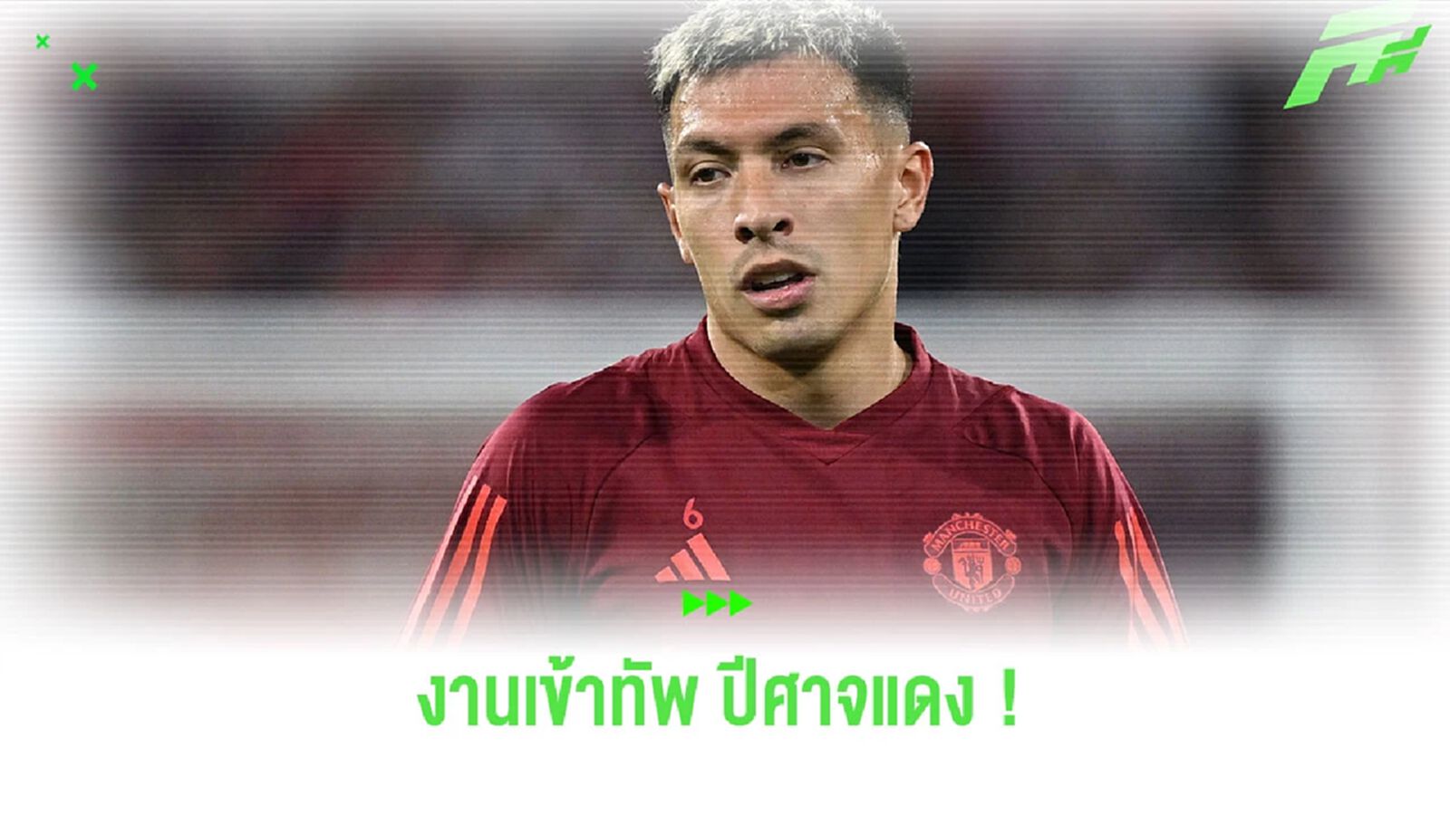 งานเข้า! “มาร์ติเนซ” ขึ้นเขียงผ่าตัด พลาดช่วย “แมนยูฯ” หลายเดือน