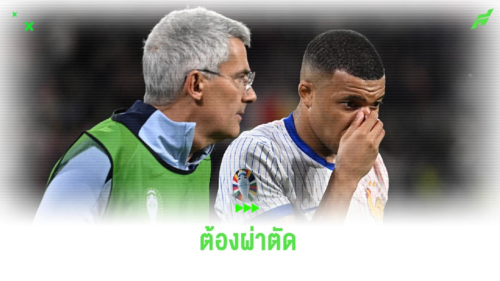เดส์ช็องส์ ยัน ! เอ็มบัปเป้ ต้องผ่ารักษาจมูกหัก
