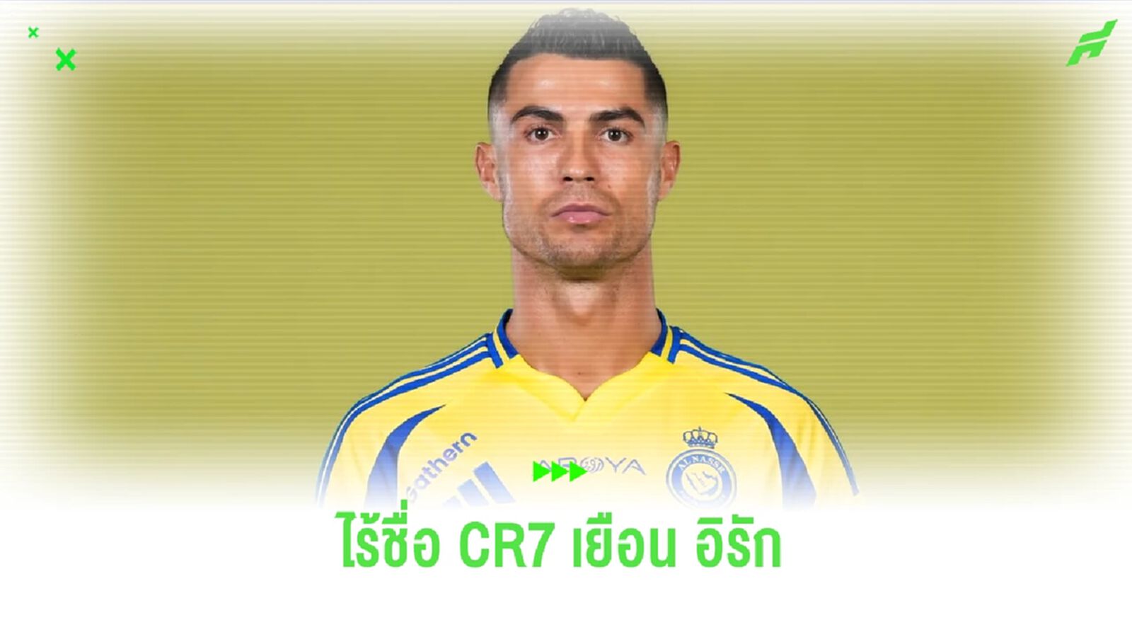 อัล-นาสเซอร์ เซ็ง ! โรนัลโด้ ป่วยชวดเกม AFC แชมเปี้ยนส์ ลีก