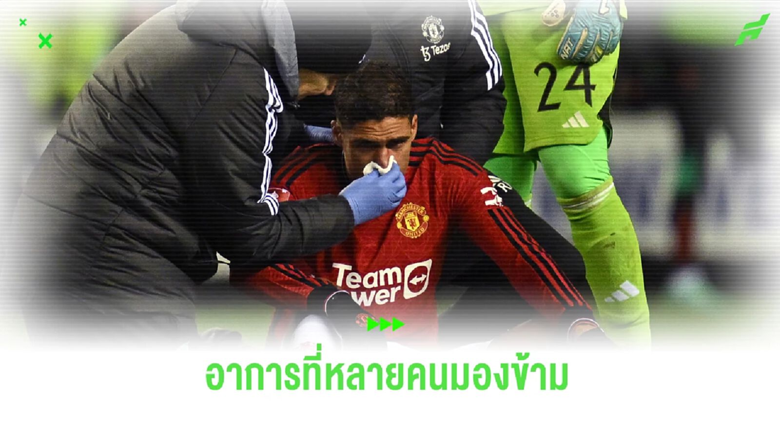 เรื่องเล็กๆใกล้ตัว! อาการคอนคัสชั่น ภัยเงียบฉุดรั้ง ราฟาเอล วาราน เรื่องเล็กๆใกล้ตัว! อาการคอนคัสชั่น ภัยเงียบฉุดรั้ง ราฟาเอล วาราน